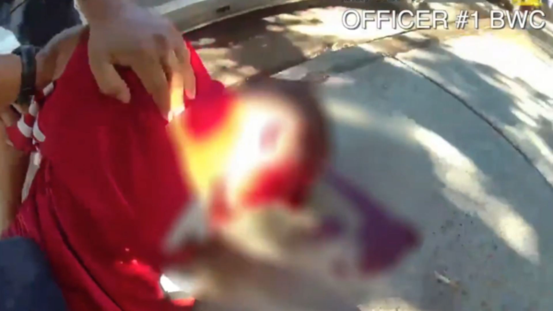 Suspect Shot In The Head By Sacramento Police During Takedown [WATCH]